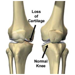 ���⤫��չ,glucosamine,���������,�ä���������,���ѡ�Ң��������,���ѡ���ä���������,���⤫��չ���࿵,glucosamine sulfate